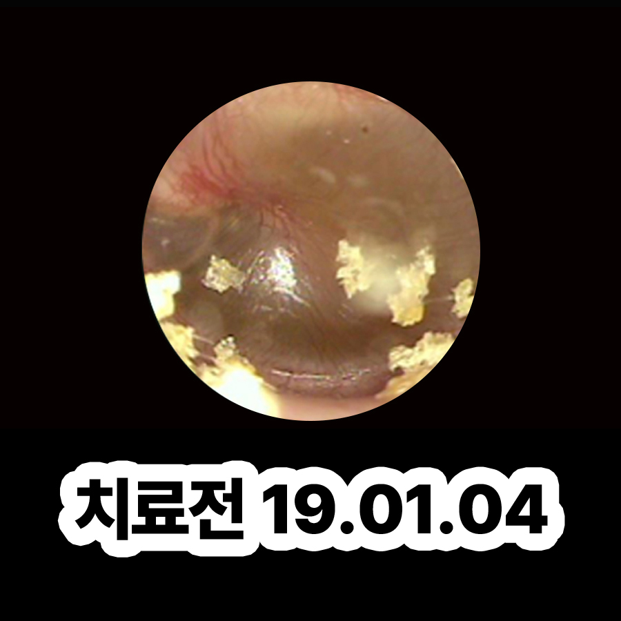 분당 중이염 병원 관련 이미지 2