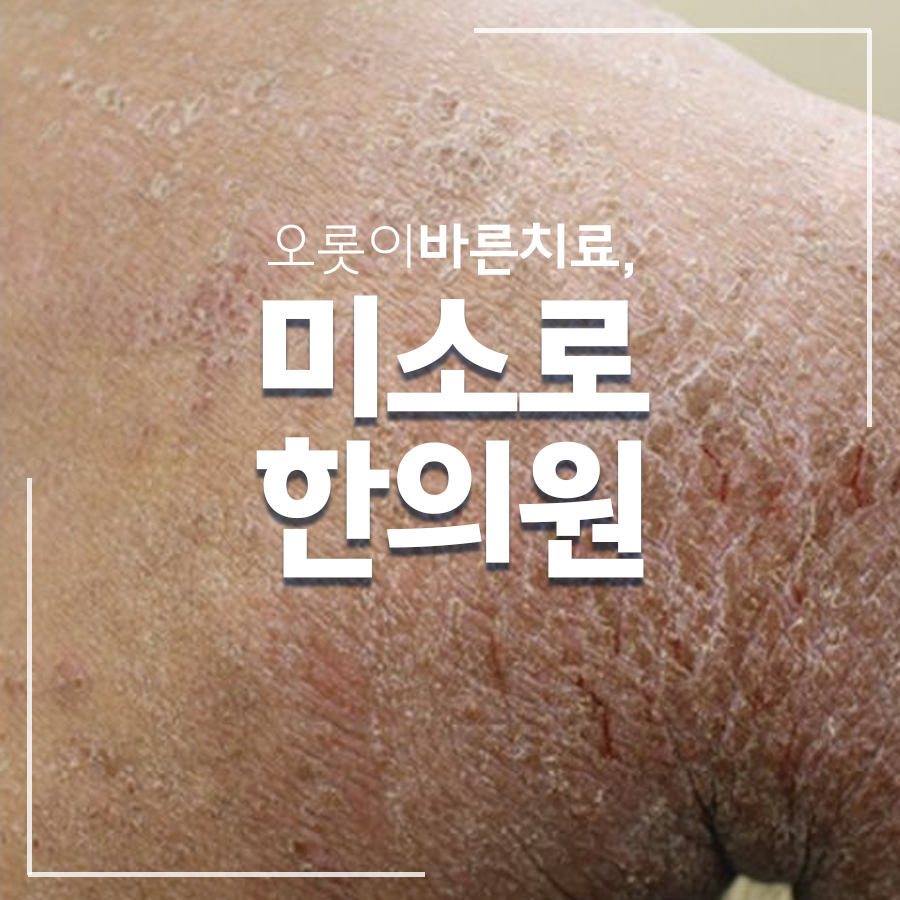 송도 유아 아토피 치료병원 관련 이미지 1