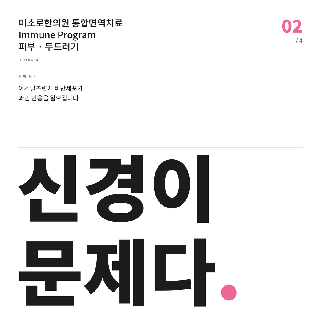 두드러기 신경이 문제다