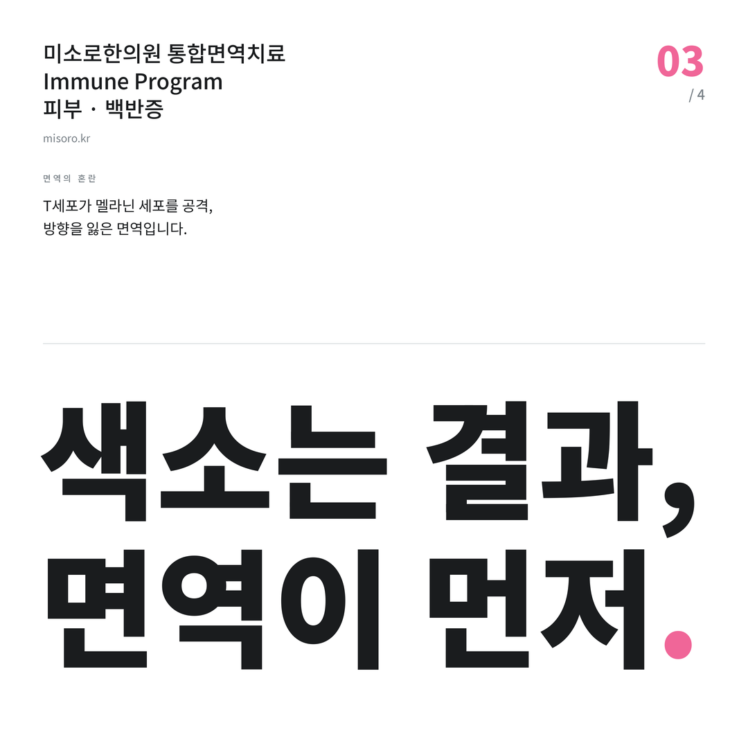논산 백반증 색소는 결과, 면역이 먼저