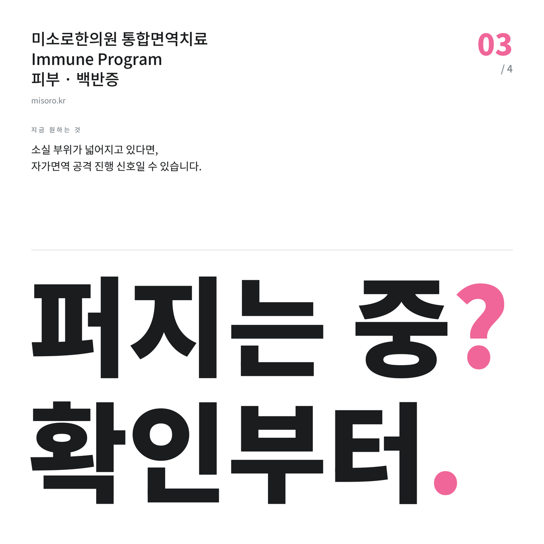 연수동 백반증 퍼지는 중? 확인부터
