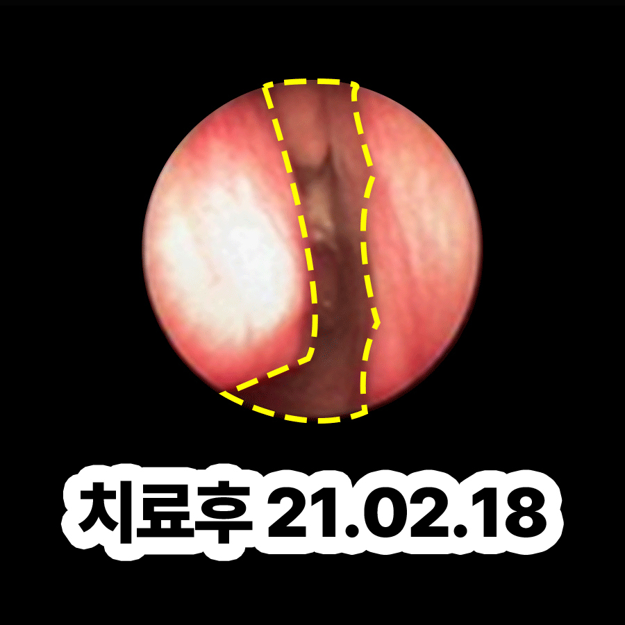 분당 축농증치료한의원 관련 이미지 3