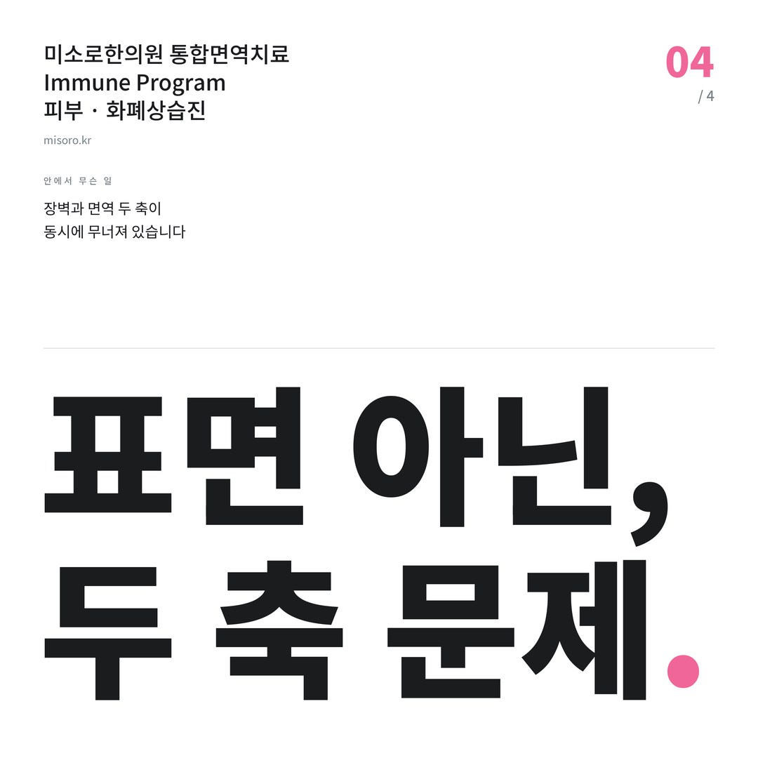 수지 화폐상습진 표면 아닌, 두 축 문제