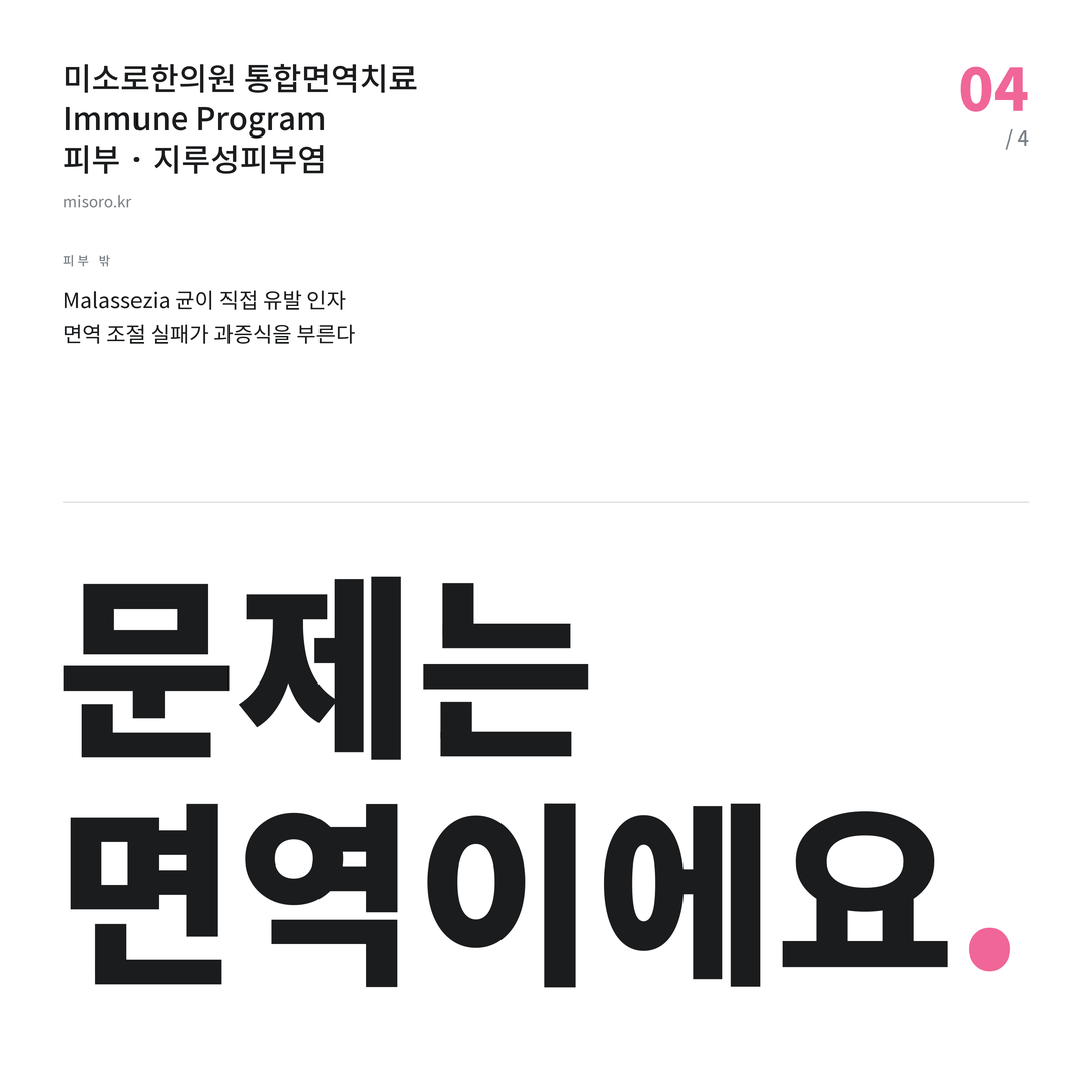 계산동 지루성피부염 문제는 면역이에요