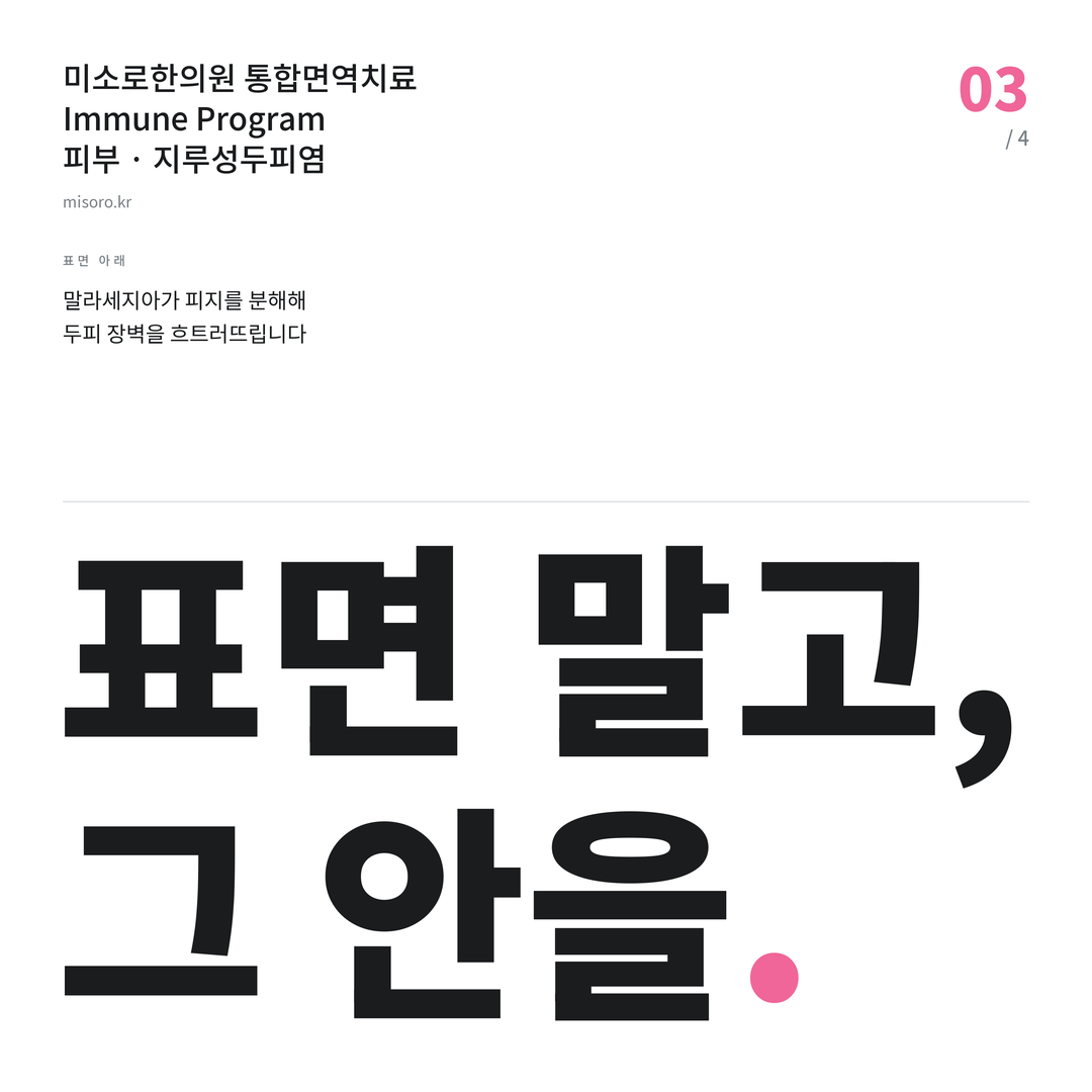 인천 지루성두피염 표면 말고, 그 안을